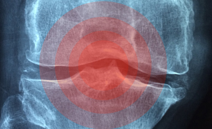 Arthrose bei Hunden was hilft meinhundistkrank.de